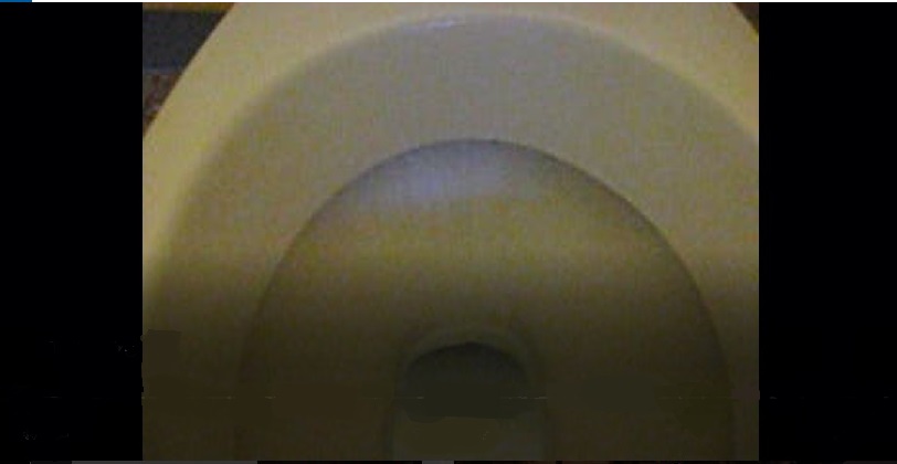 Toilet Frogs